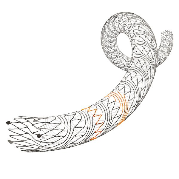 PRECISE® PRO RX™ Carotid Stent Delivery System