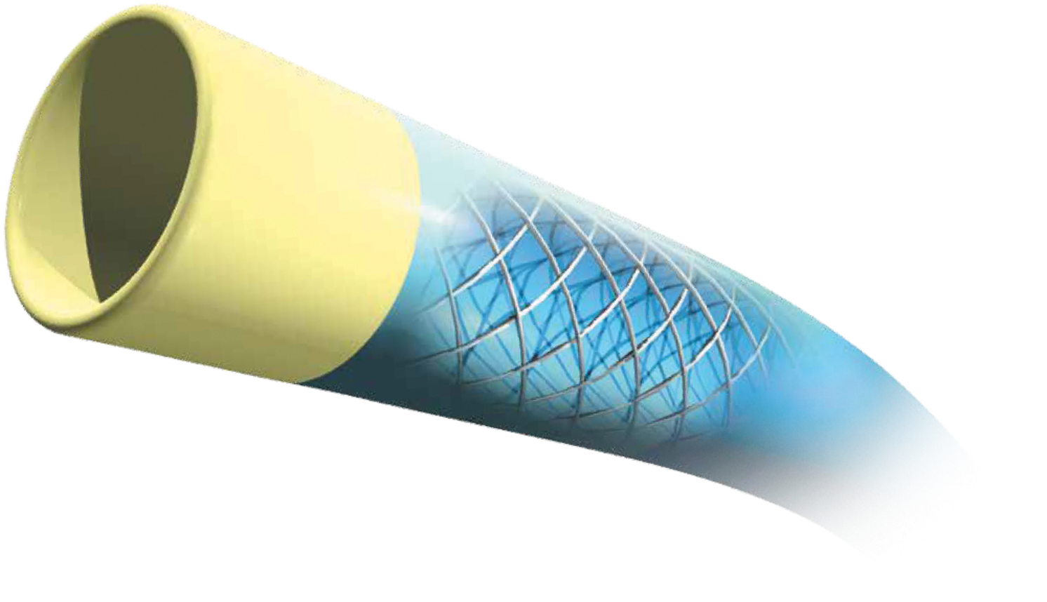 VISTA BRITE TIP® Guiding Catheter – Multipurpose A (MPA)